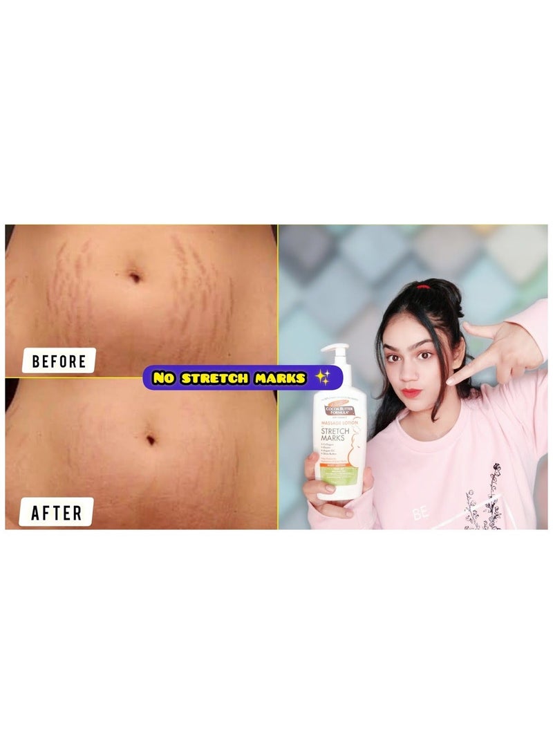 PALMER'S لوسيون تدليك لعلامات التمدد 250 مل - Image 2